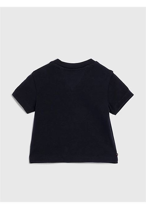  Tommy Hilfiger | KN0KN01669DW5